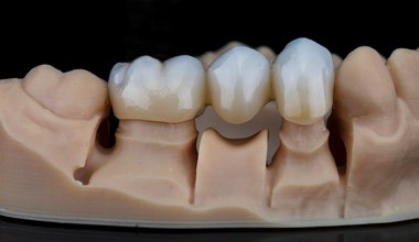 Why Are My Teeth Translucent? Exploring the Top Causes and Solutions