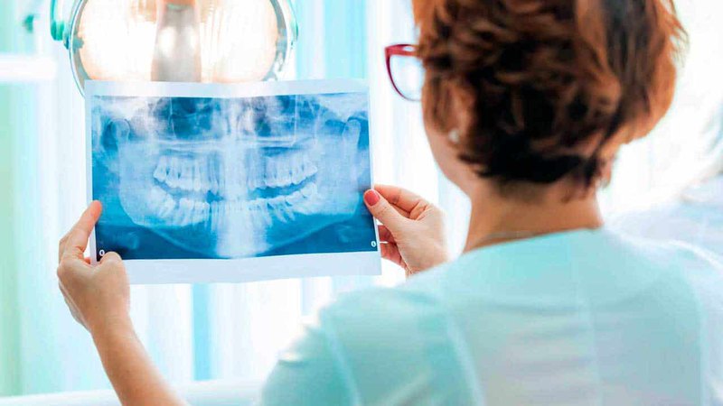 A dental X-ray like the ones that we do at King of Prussia Dental Associates.