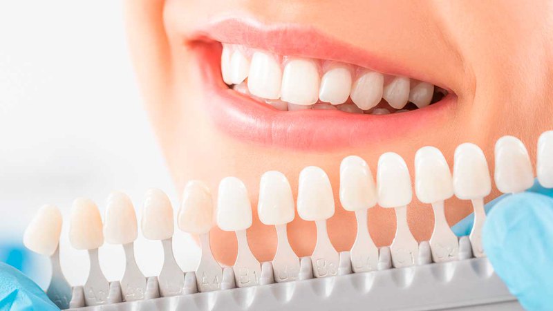 Modern aesthetic dentistry techniques can give anyone a brilliant smile and straight, even teeth