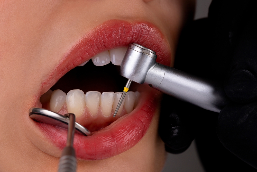 Scaling and Root Planing with King of Prussia Dental™