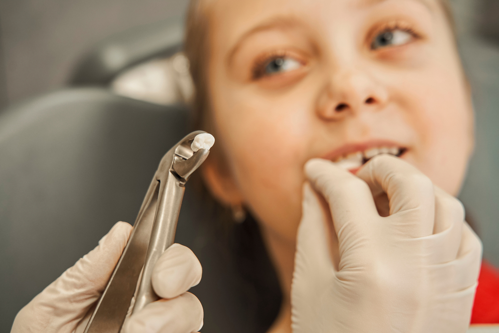 Safe Baby Tooth Extraction in King of Prussia, PA