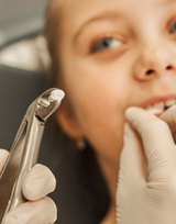 Child Tooth Extraction