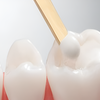 Fillings